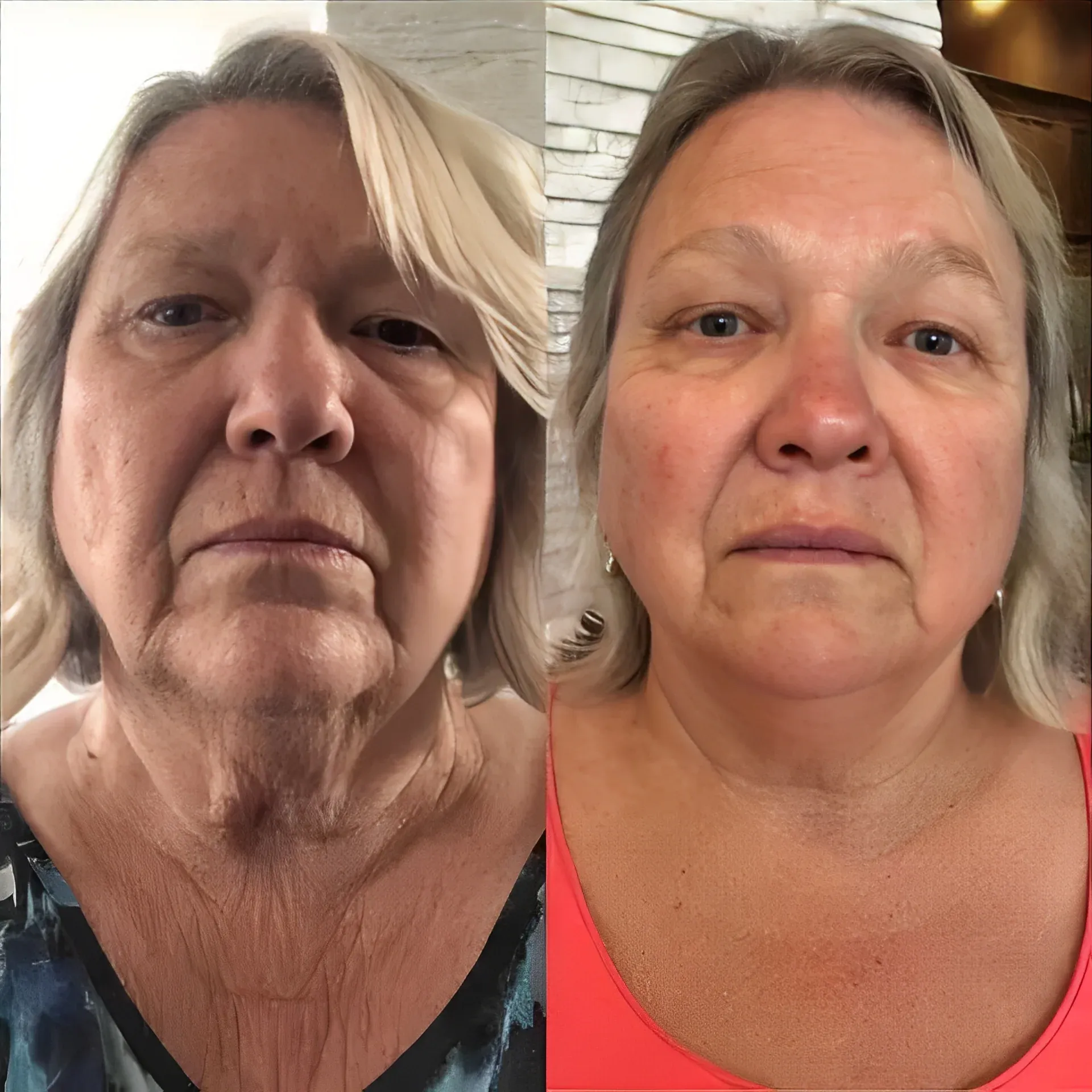 imgi_162_pulse_2_b_and_f_480x480_ba196ddc-8e88-4f99-bc3f-5cec48376b14