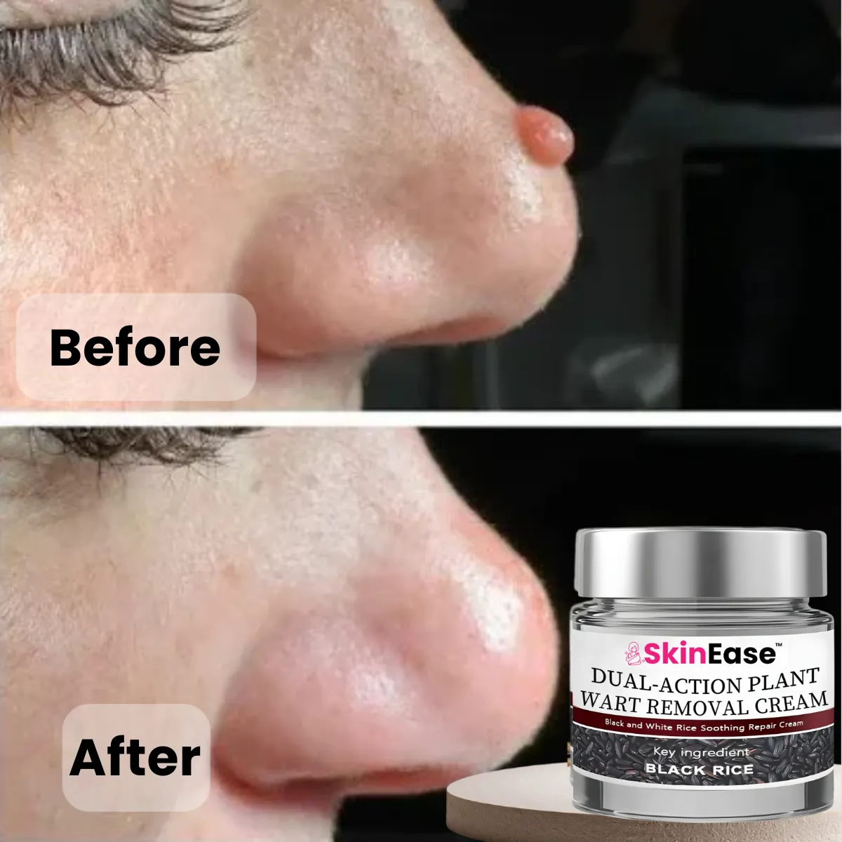 imgi_25_1765424055-SkinEase (1)