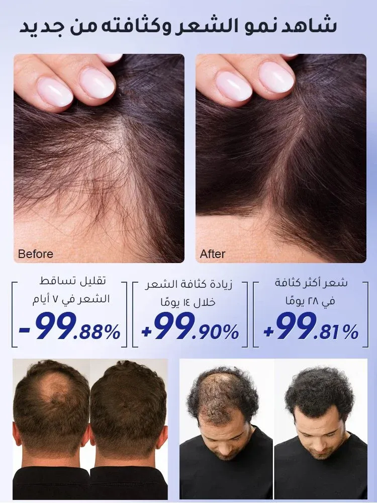 imgi_3_dfde89c883e23378da605368975f8183